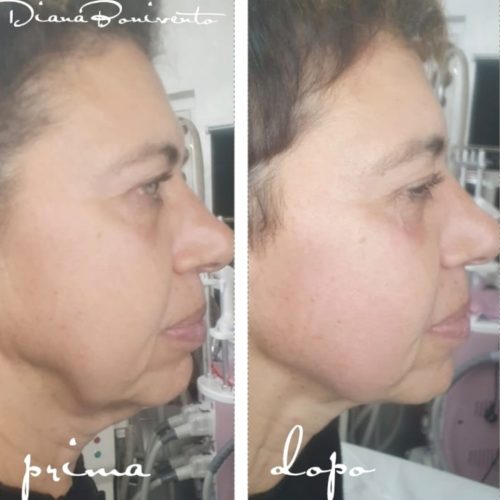 Potenziatore Muscolare Viso